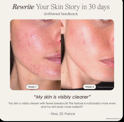 LED Lichttherapie Maske für Strahlende Haut™ Nur 89,99 € statt 119,99 €!