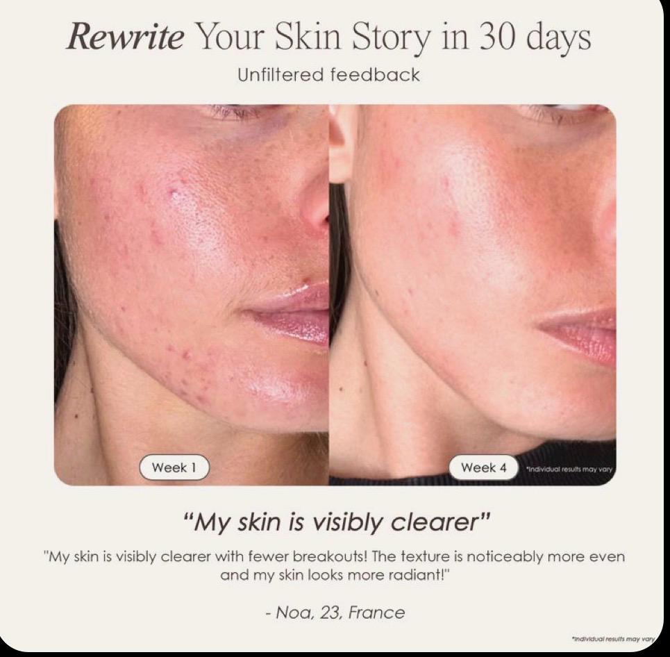 LED Lichttherapie Maske für Strahlende Haut™ Nur 89,99 € statt 119,99 €!