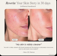 LED Lichttherapie Maske für Strahlende Haut™ Nur 89,99 € statt 119,99 €!